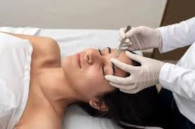 Express-Dermaplanning