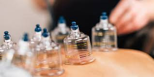 Dry Cupping (unlimited)