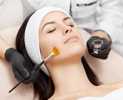 Chemical Peel